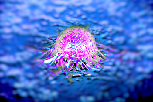 prostate cancer cell